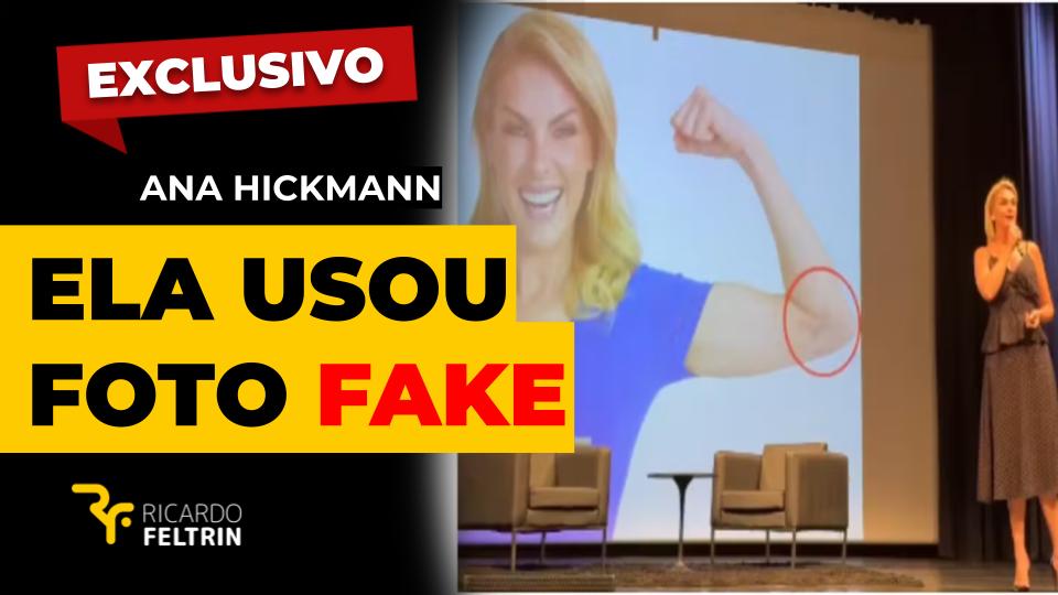 Ana Hickmann usou foto ‘fake’ de agressão que disse ter sofrido do ex-marido no ano passado